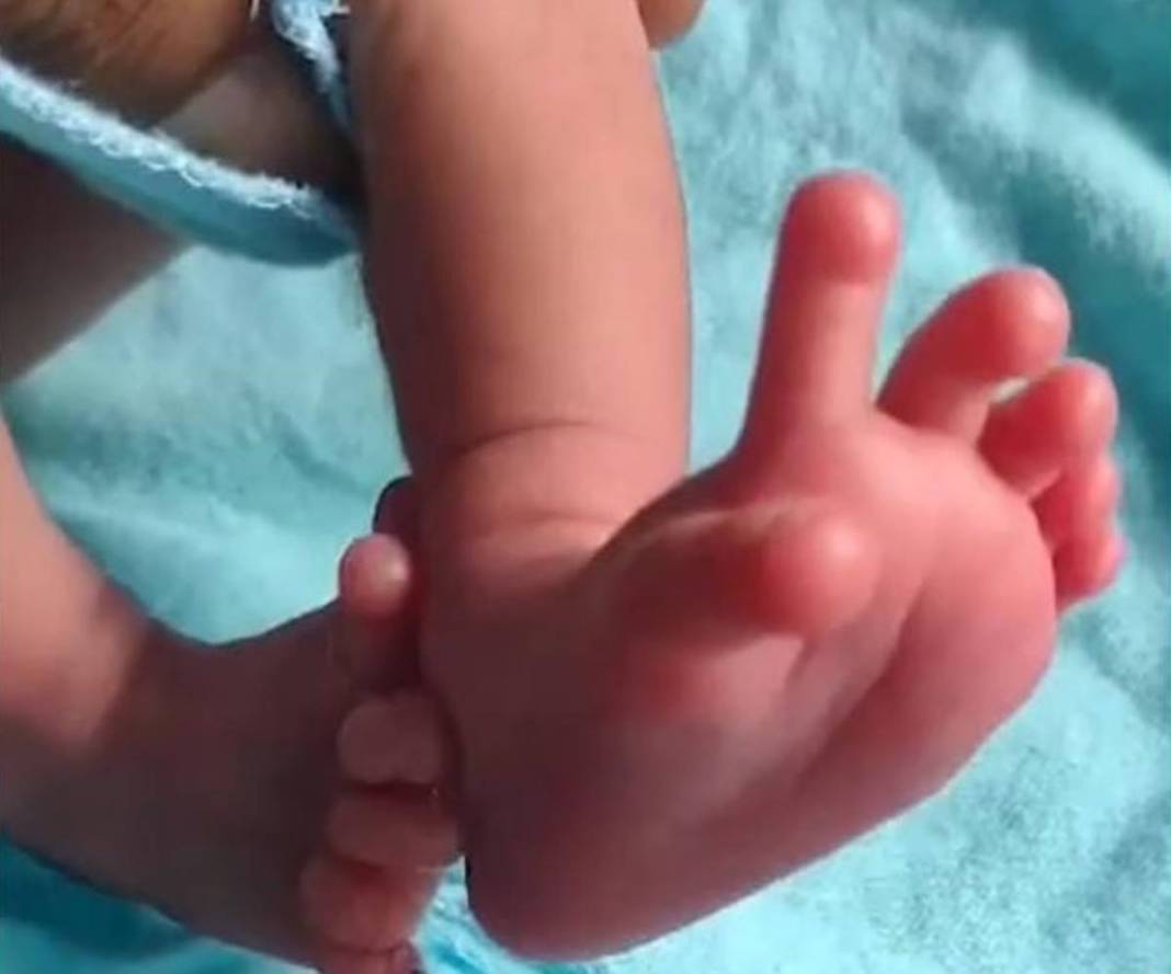 Görenler hayrete düşüyor: 26 parmaklı bebek dünyaya geldi! Esas ilginç olan ise bebeğin 'tanrıça' ilan edilmesi 5